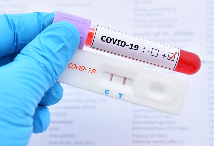 Kenapa Hasil Test COVID-19 PCR dan Antigen Bisa Berbeda? 