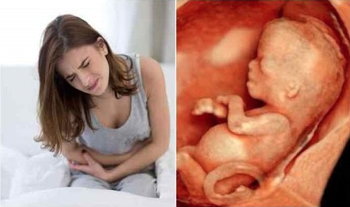 Hiện tượng thai lưu 3 tháng đầu cách nhận biết và diễn biến để mẹ phòng tránh nguy hiểm