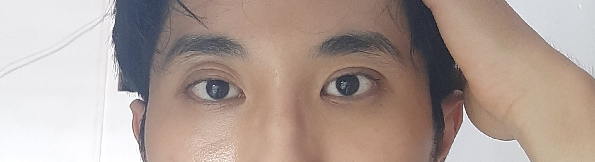 Vấn đề về mắt