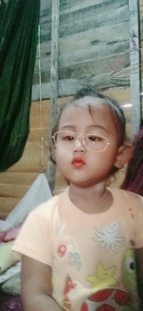Ap bayi prematur yg GK bisa melihat bisa di sembuhkan 