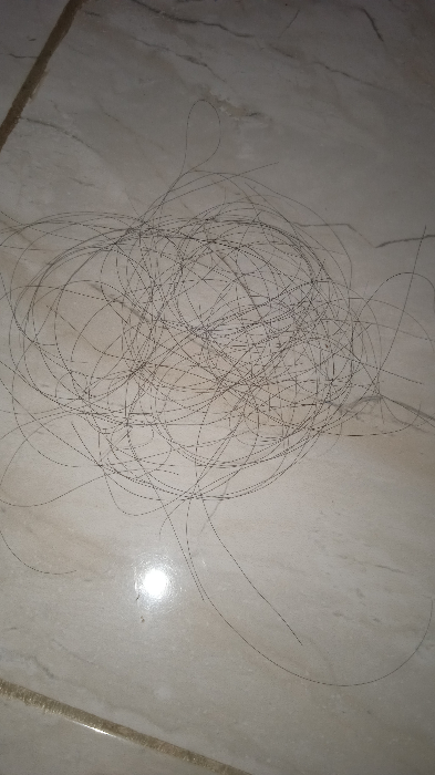 Rambut rontok tak berkesudahan