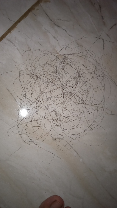 Rambut rontok tak berkesudahan