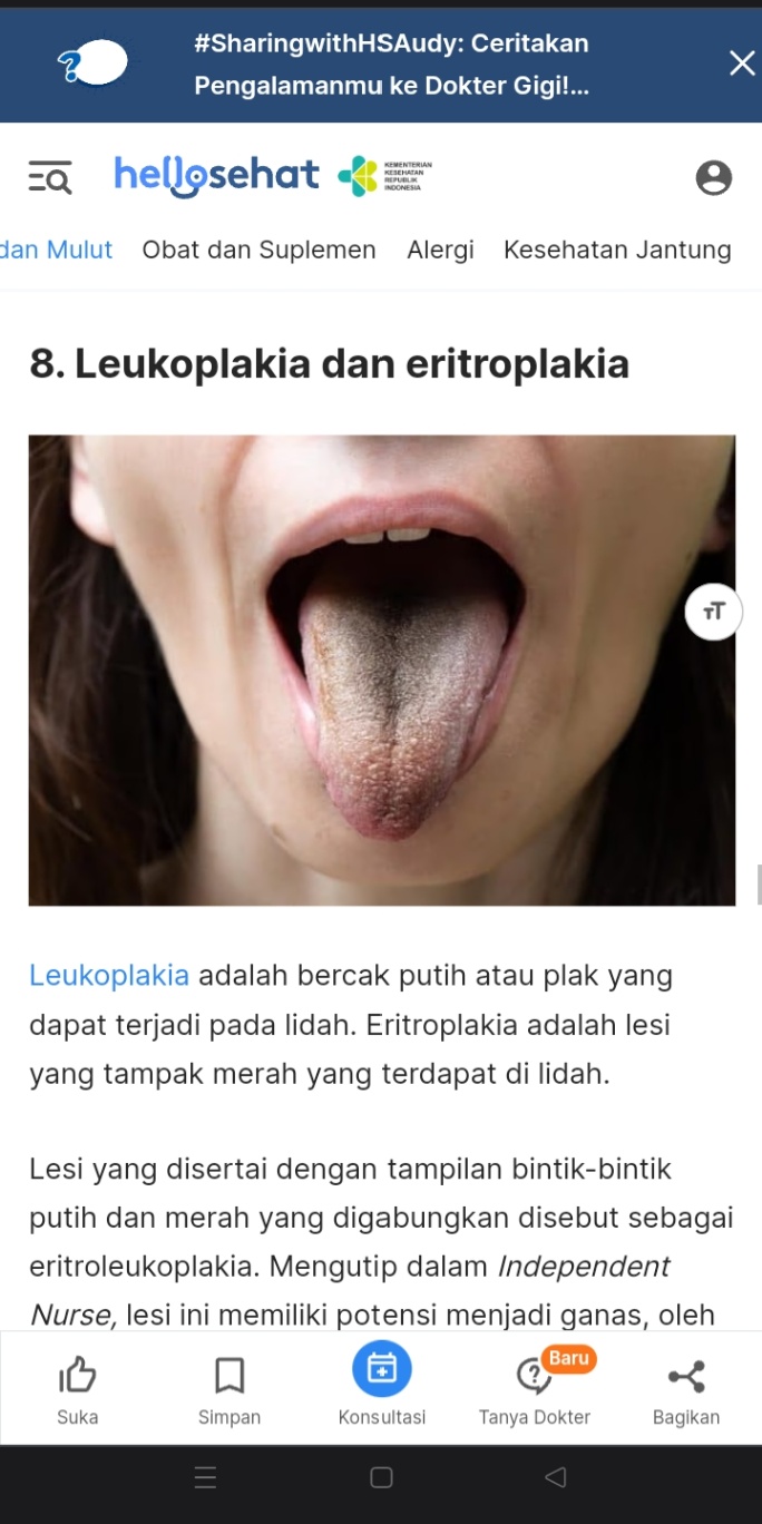 Cara mengatasi lidah seperti ini gimana dok ?