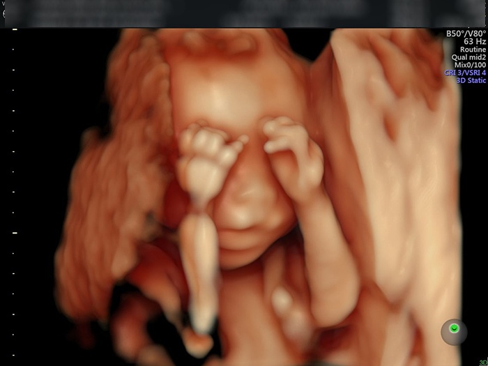 Thai nhi 22 tuần đã có những đường nét rõ nét trên cơ thể, và siêu âm thai giúp chúng ta xem những hình ảnh kỳ diệu này. Cùng nhìn vào khuôn mặt xinh xắn, những cử chỉ yêu thương và quỳnh bút tinh khôi của thai nhi, để cảm nhận được hương vị của cuộc sống.
