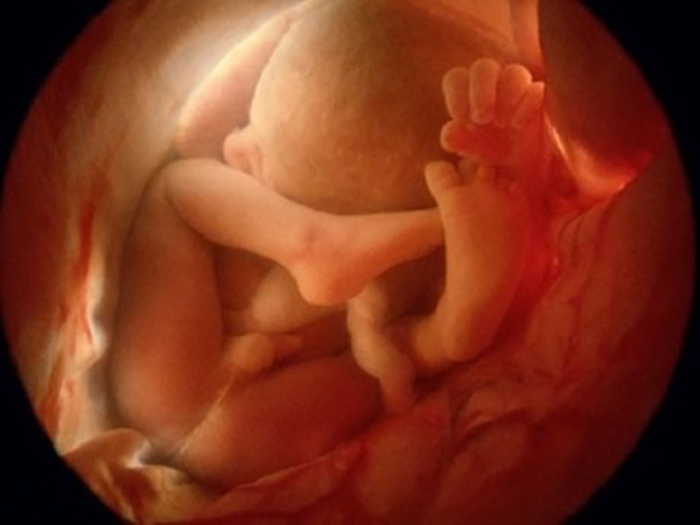 Hãy dành chút thời gian để xem ảnh siêu âm 4D thai nhi tuyệt đẹp này để cảm nhận được cuộc sống đang nảy nở bên trong bạn. Chắc chắn bạn sẽ cảm thấy kinh ngạc trước những hình ảnh sống động và chi tiết đến từng chi tiết nhỏ nhất của đứa trẻ của mình.