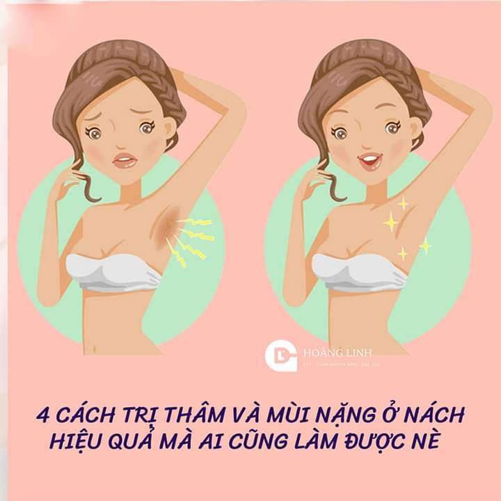 4 cách trị thâm nách