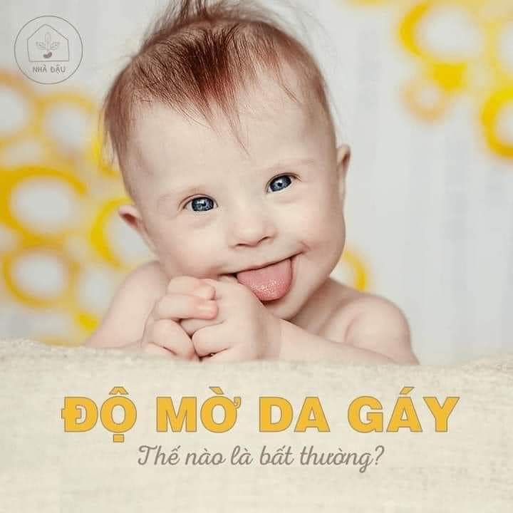 Vì sao Mẹ KHÔNG BAO GIỜ nên bỏ qua siêu âm ĐỘ MỜ DA GÁY