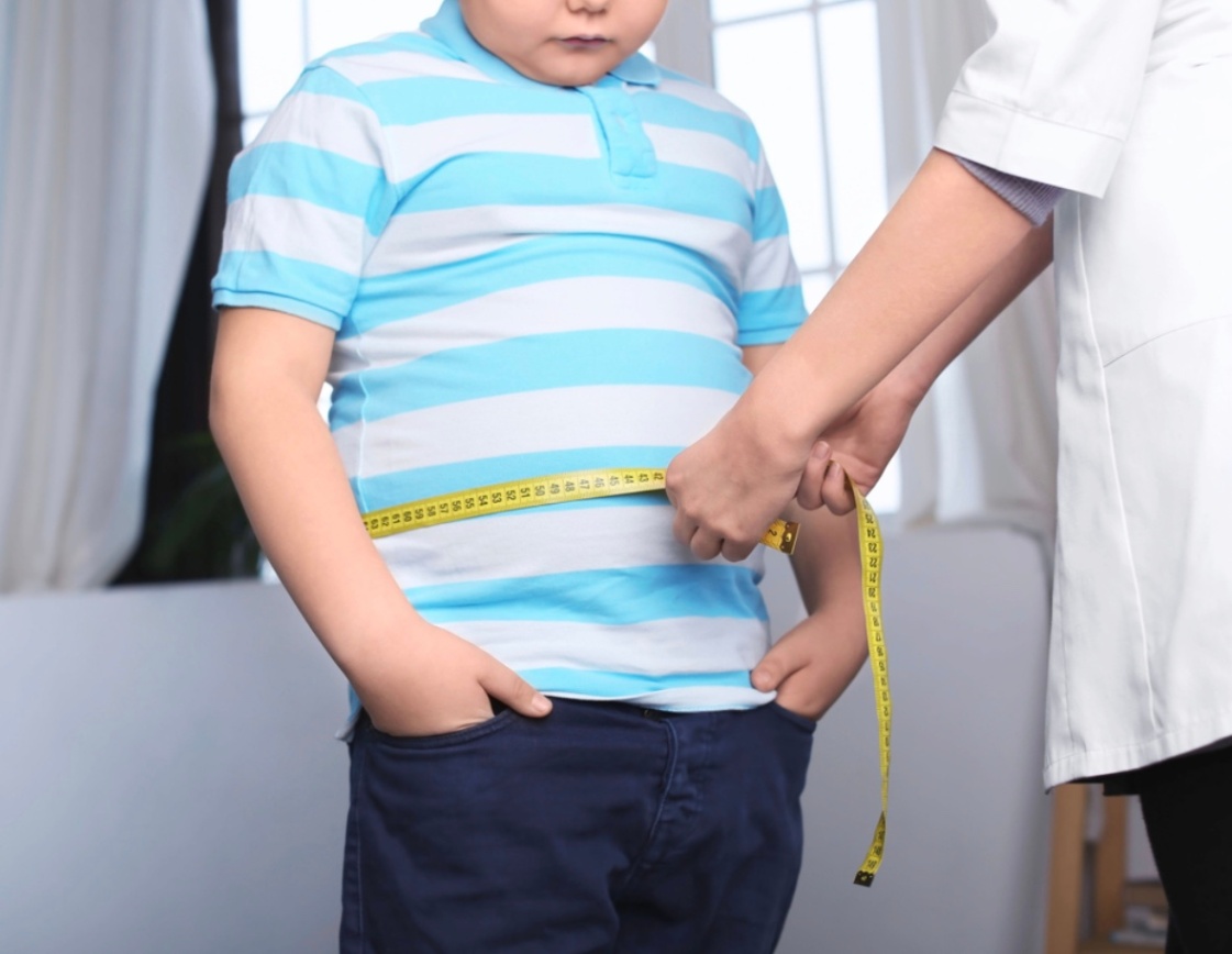 Cách giảm cân cho trẻ phù hợp giúp bé hợp tác tốt với ba mẹ 