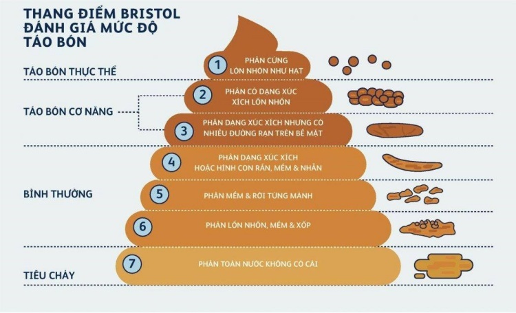 Đoán bệnh qua màu phân của trẻ