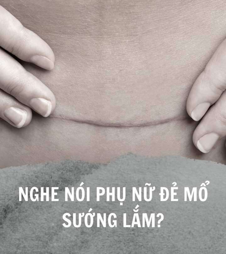 NGHE NÓI PHỤ NỮ ĐẺ MỔ SƯỚNG LẮM