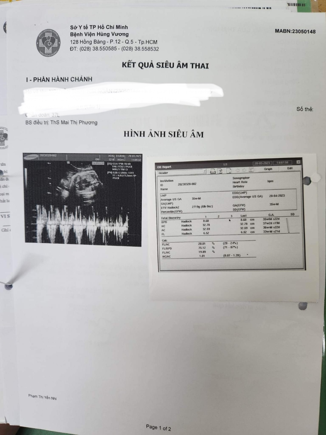 Bầu 37 tuần thai nhi bị giãn bể thận nhẹ có sao  không?