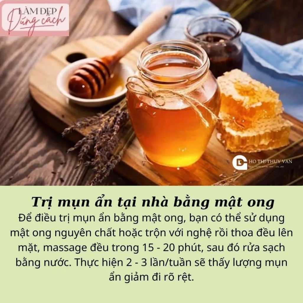 3 cách trị mụn ẩn hiệu quả tại nhà, ai cũng nên biết