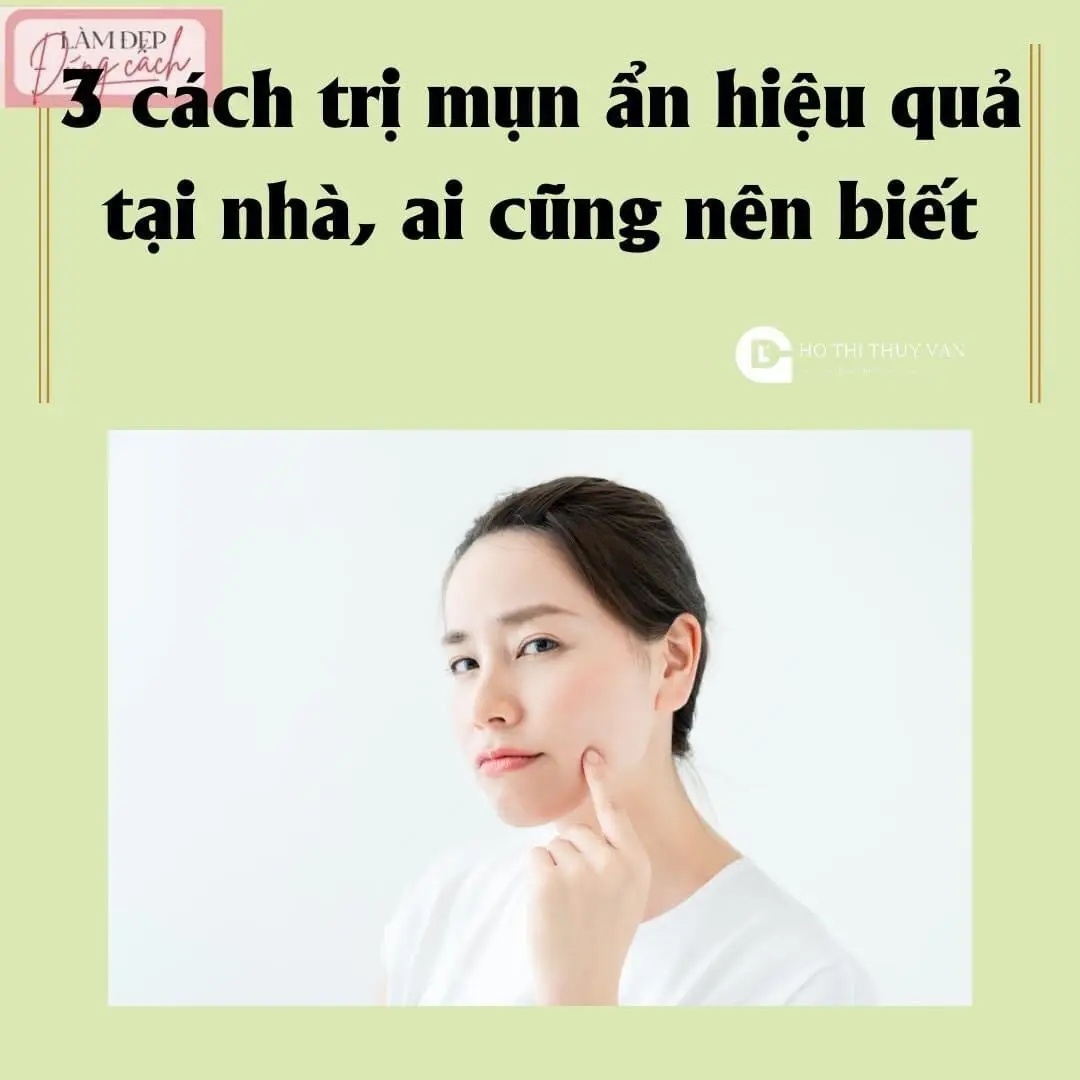 3 cách trị mụn ẩn hiệu quả tại nhà, ai cũng nên biết