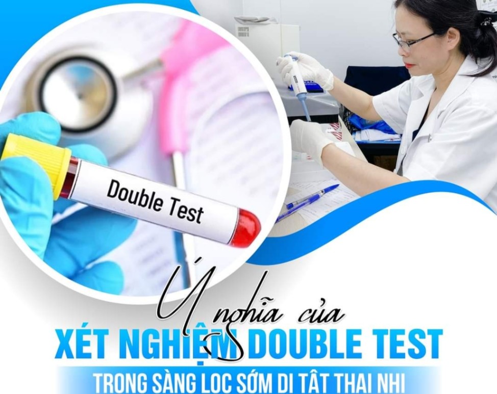 Ý nghĩa của xét nghiệm double test trong sàng lọc dị tật sớm cho thai nhi 👍👍👍