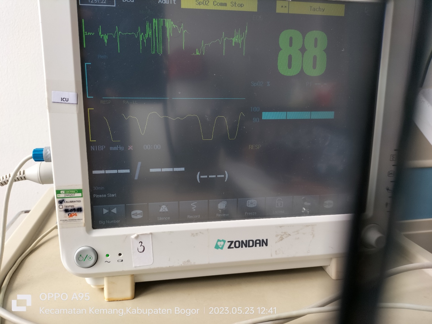 Tampilan monitor ICU