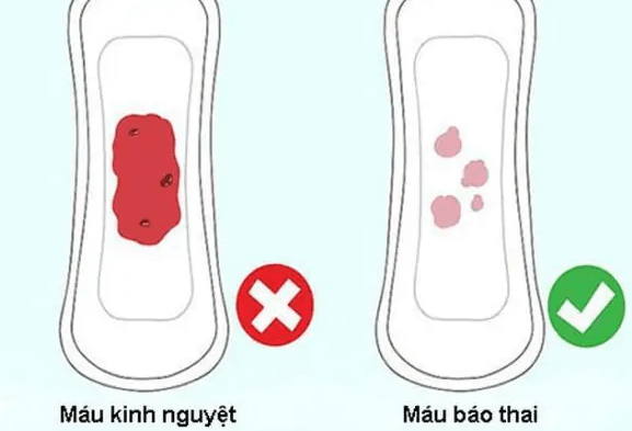 Hình ảnh máu báo thai và máu kinh khác nhau ra sao?