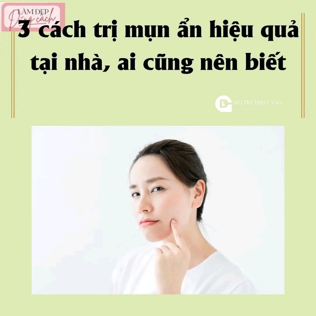 3 cách trị mụn ẩn hiệu quả tại nhà, ai cũng nên biết