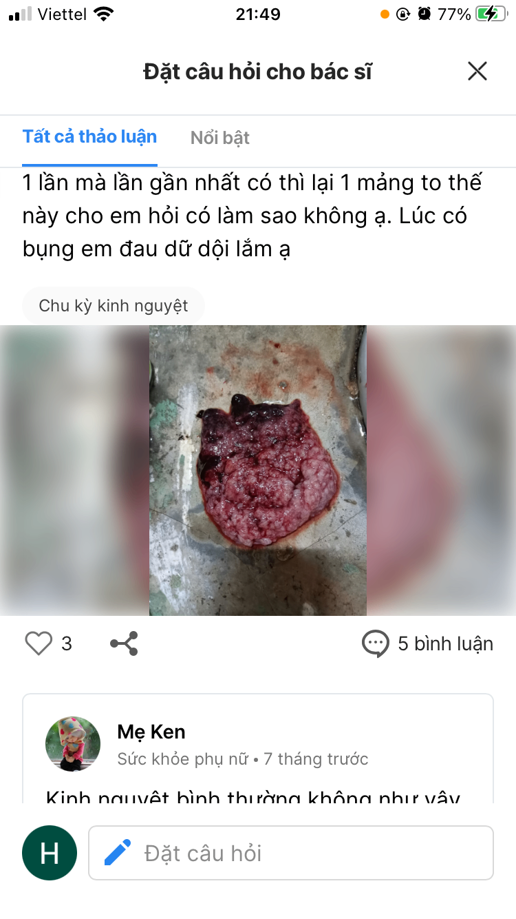 Kinh nguyệt không đều