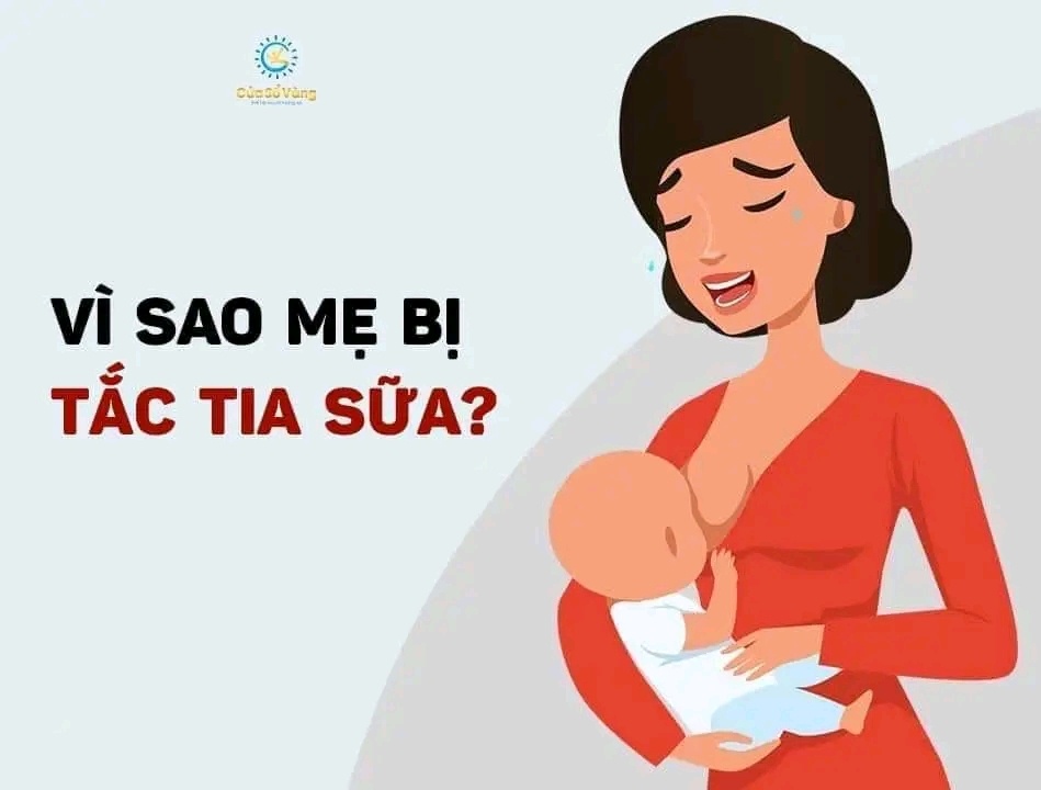 VÌ SAO MẸ BỊ TẮC TIA SỮA?