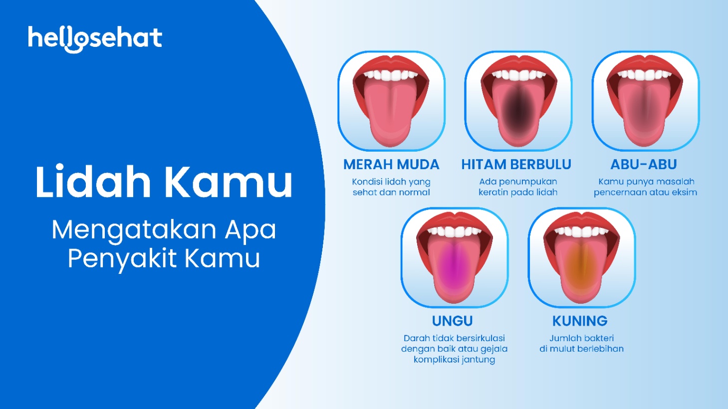 Arti Warna Lidah, Mulai dari yang Normal hingga Tak Sehat