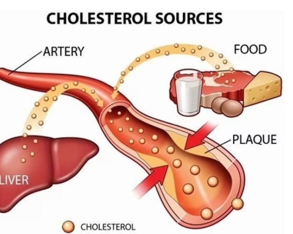 Chỉ số cholesterol là gì? bao nhiêu là hợp lý