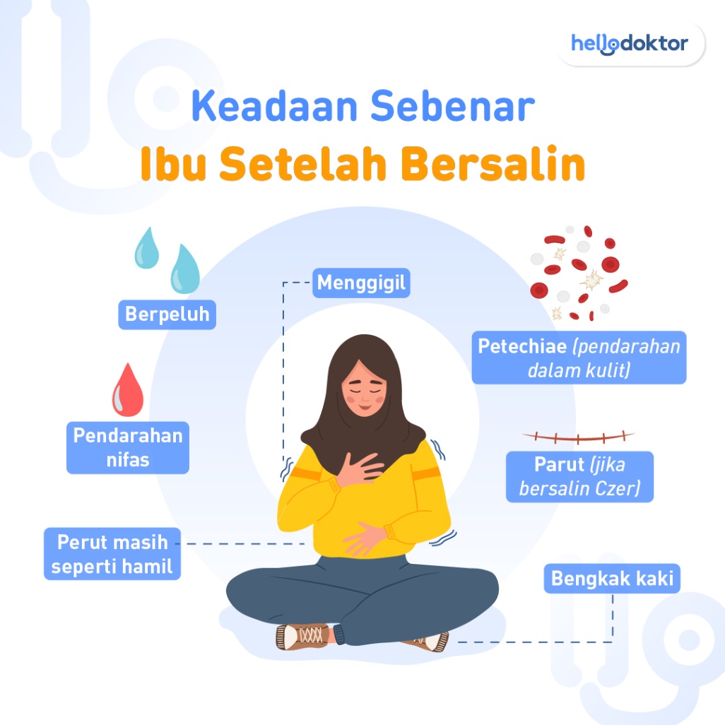 Keadaan sebenar ibu setelah bersalin