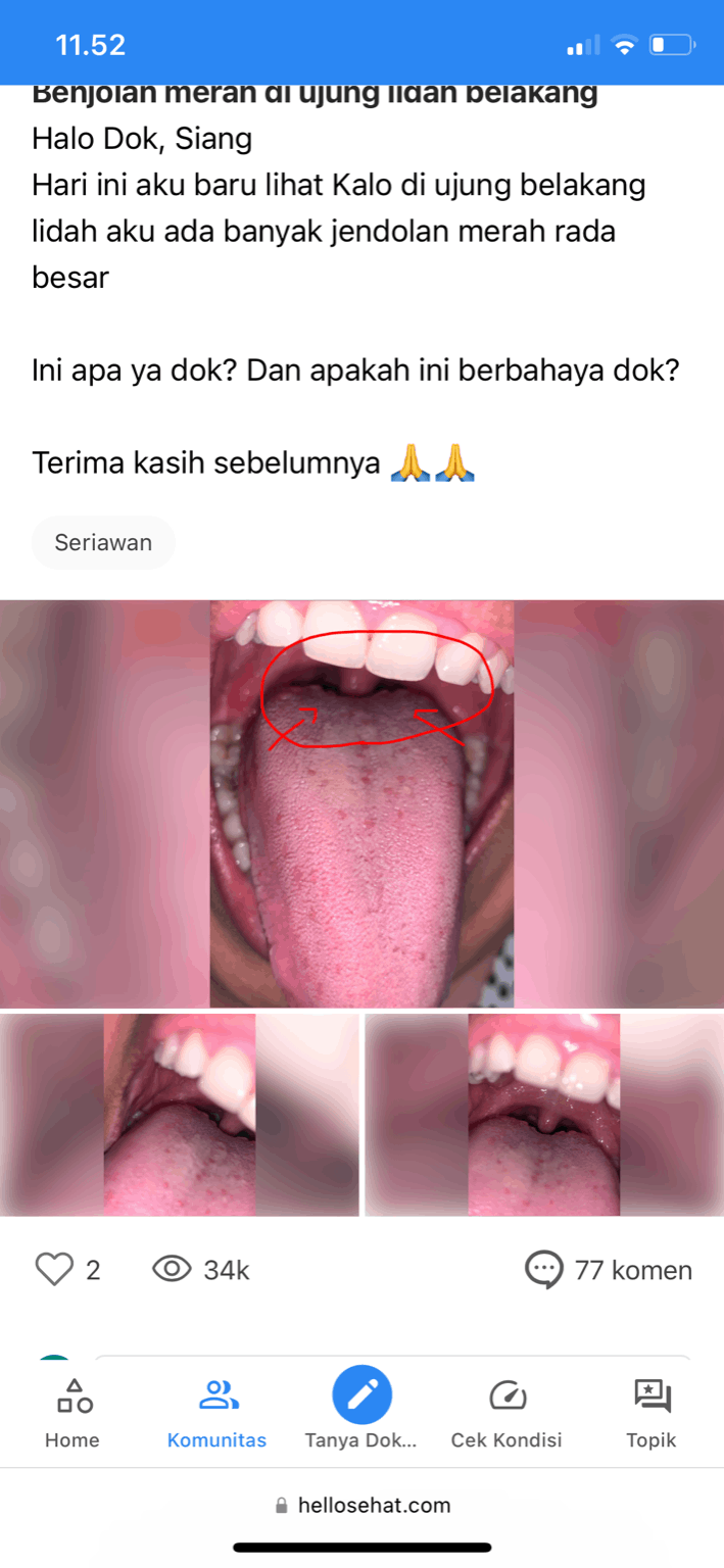 permasalahan pada lidah