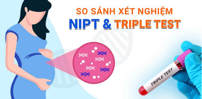 Đã xét nghiệm Nipt có cần xét nghiệm Triple Test nữa hay không?