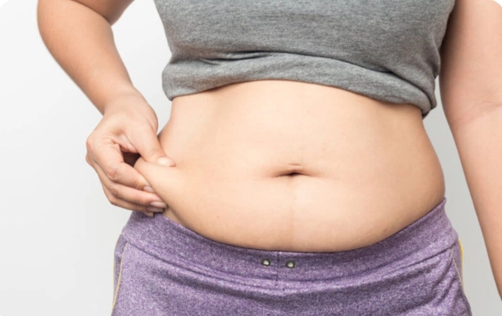 Bụng bầu và bụng mỡ có gì khác nhau?  