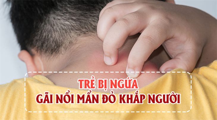 Ngứa khắp người càng gãi càng ngứa tiềm ẩn bệnh lý nguy hiểm