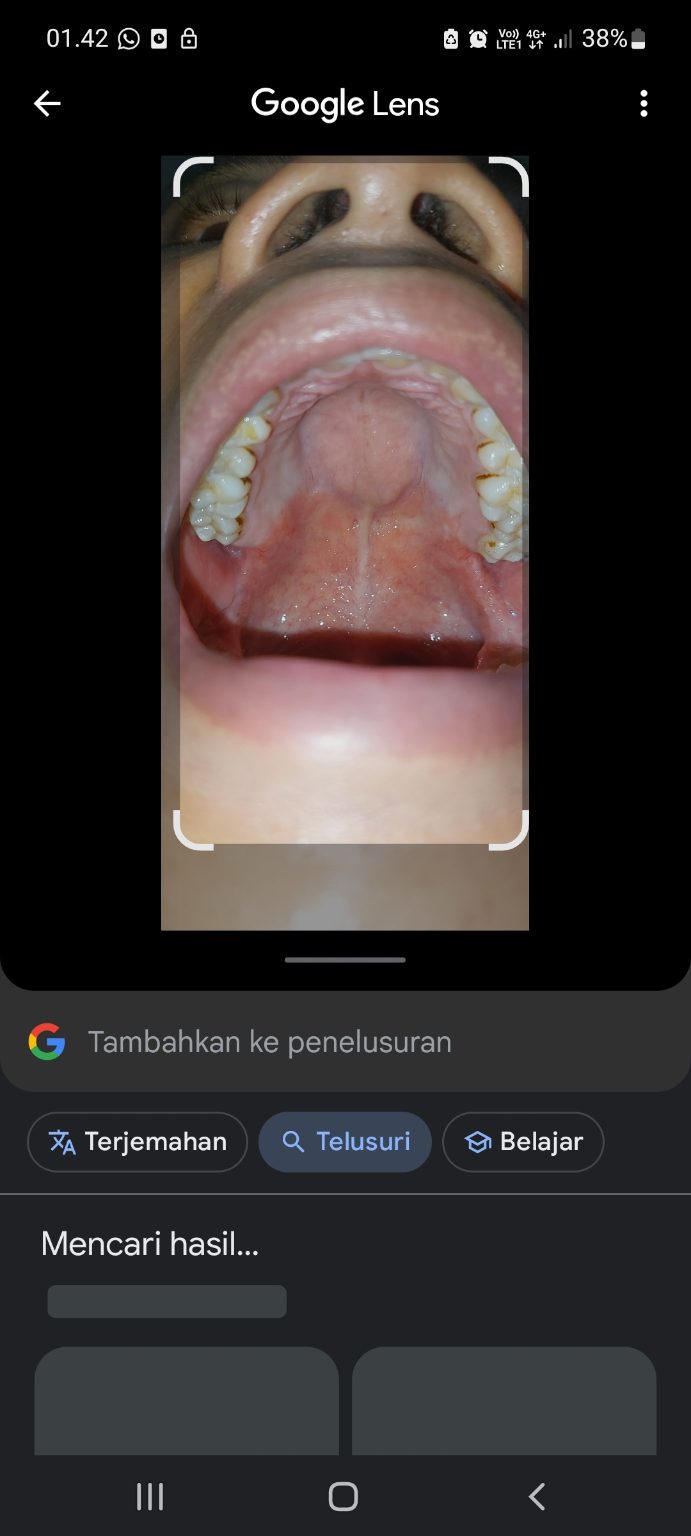 Gigi dan mulut