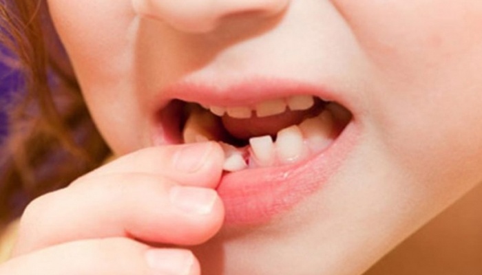 Nằm mơ thấy rụng răng là điềm tốt hay xấu?