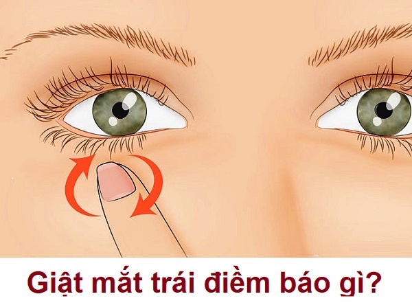 Mắt trái giật là điềm tốt hay xấu, cần chú ý điều gì?