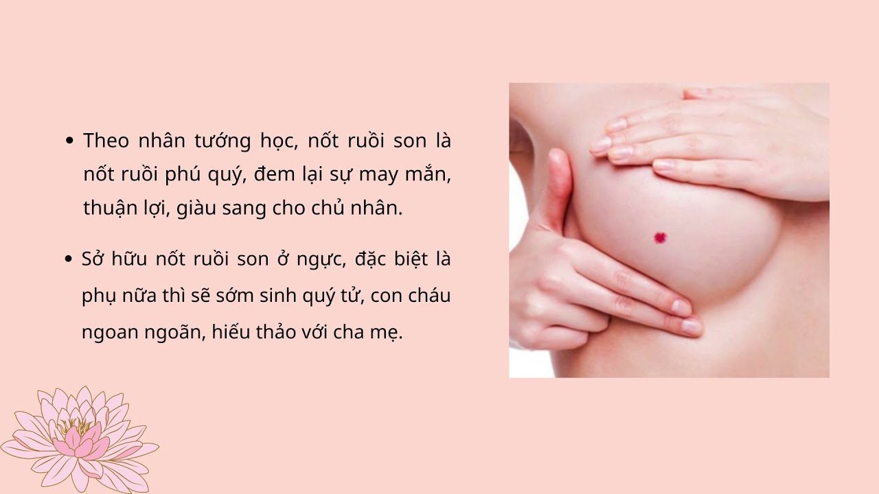 4. Các loại nốt ruồi đặc biệt khác ở ngực