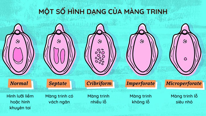 Rách Màng Trinh Chảy Máu Bao Lâu? Giải Đáp Chi Tiết