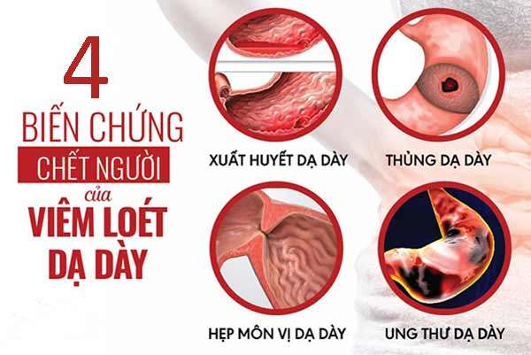 Cô gái tử vong sau 12 giờ phát hiện mắc ung thư dạ dày: Nỗi xót xa và lời cảnh tỉnh