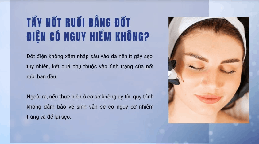 Tẩy nốt ruồi bằng đốt điện có an toàn và hiệu quả không?