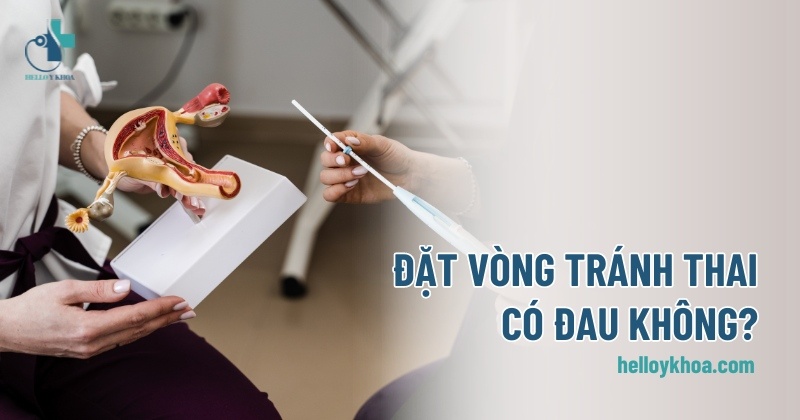 Đặt vòng tránh thai có đau không? Giải đáp thắc mắc và chia sẻ kinh nghiệm