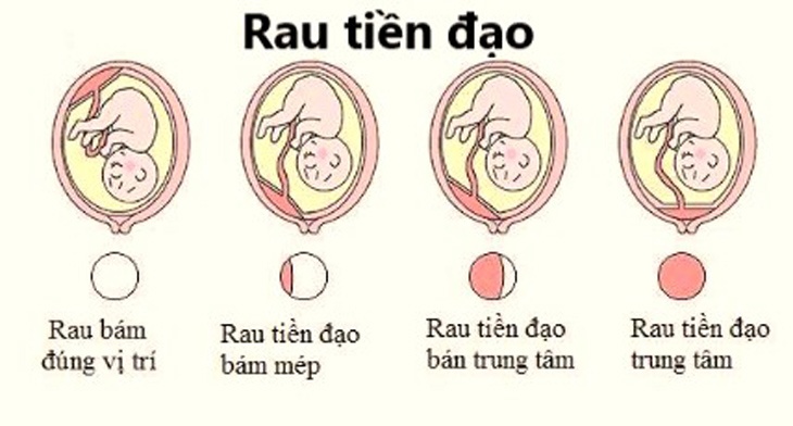 Hỏi bác sĩ