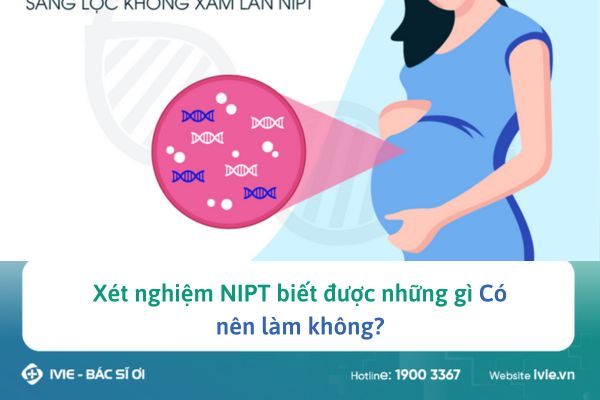 Xét nghiệm NIPT: Nên hay không nên? Giải đáp thắc mắc cho mẹ bầu 