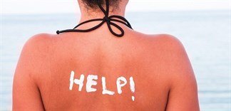 5 mẹo phục hồi da cháy nắng sau khi đi du lịch