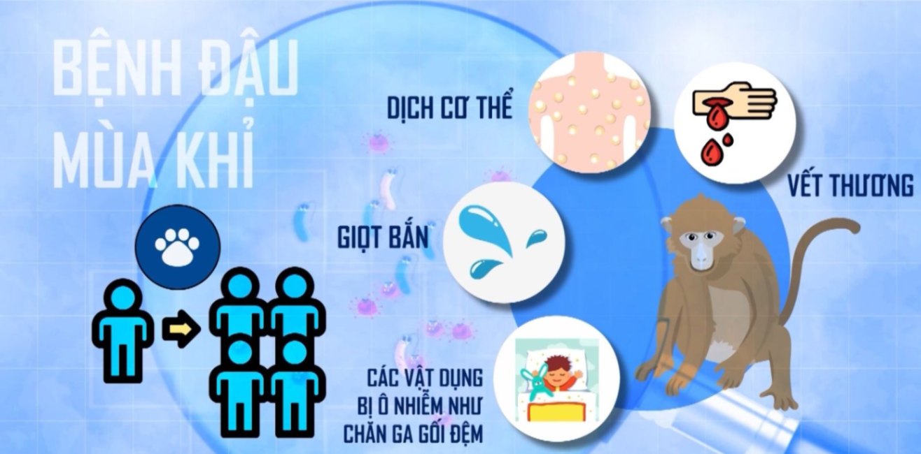 Bệnh đậu mùa khỉ: WHO cân nhắc ban bố tình trạng khẩn cấp 