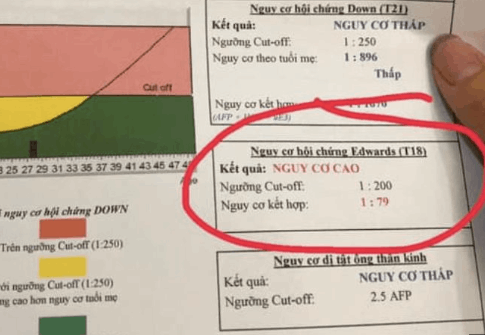 Xét nghiệm nipt biết trai hay gái chính xác không