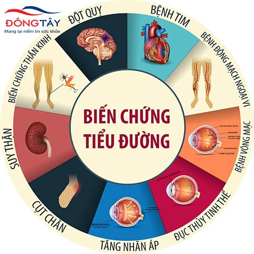 Bị tiểu đường bao lâu thì biến chứng?