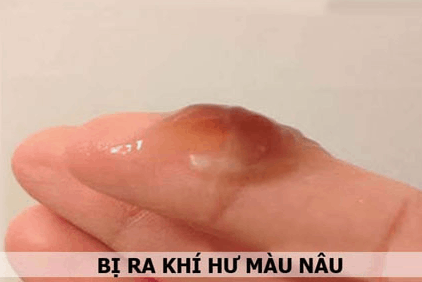 Quan hệ xong ra khí hư màu nâu