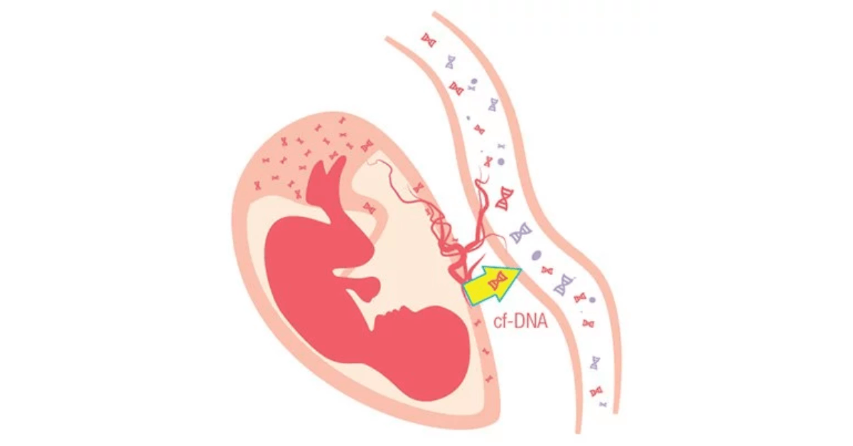 Nipt là gì? Tất tần tật về xét nghiệm Nipt