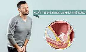 Xuất tinh ngược là gì?