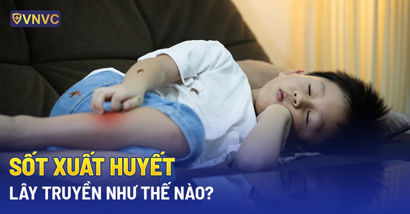 Sốt xuất huyết có lây không? Lây truyền như thế nào?