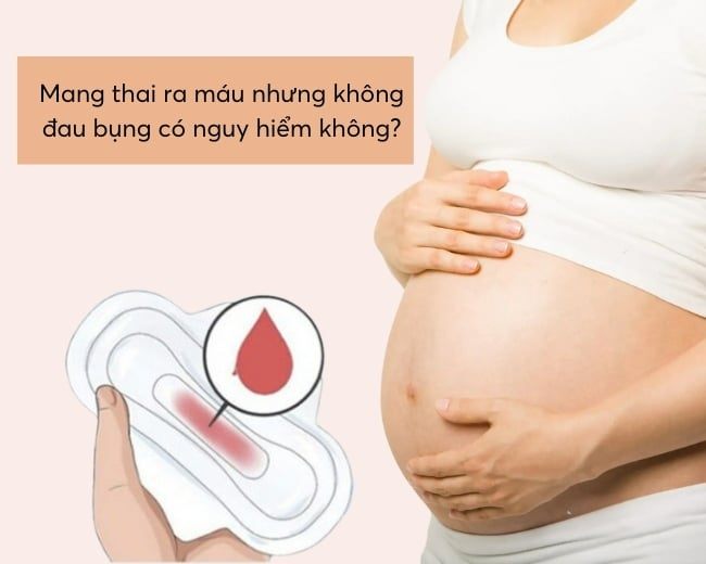 Mang thai ra máu nhưng không đau bụng: Nguyên nhân và cách xử lý