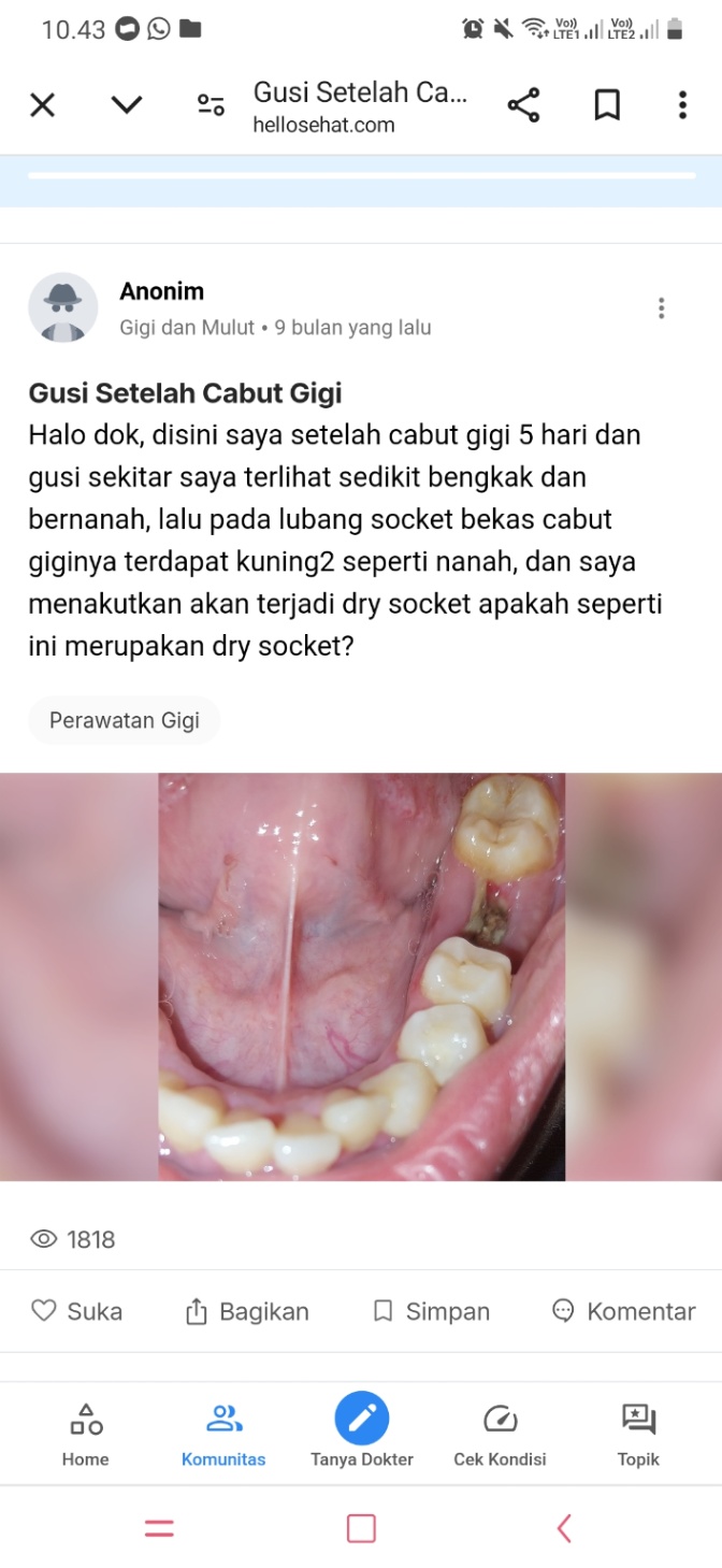 halo dok, kalo kasus nya seperti di gambar itu aman